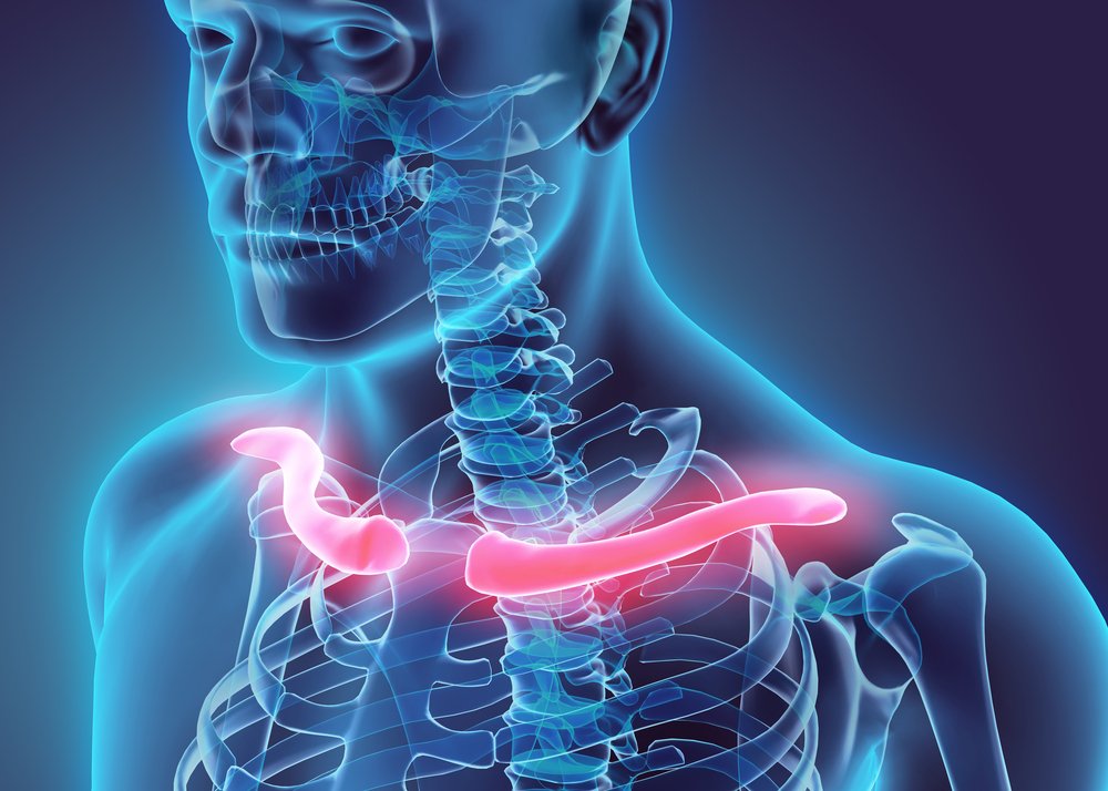 Fixation of Clavicle Fractures: A Complete Guide