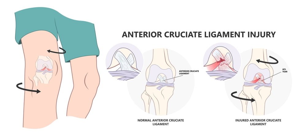 Symptoms of knee arthroscopy