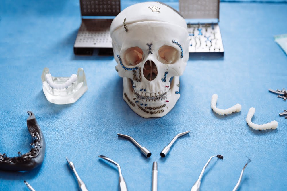 Maxillofacial Implants Manufacturer and Exporter