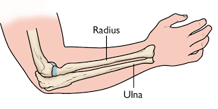 Ulna Fracture 