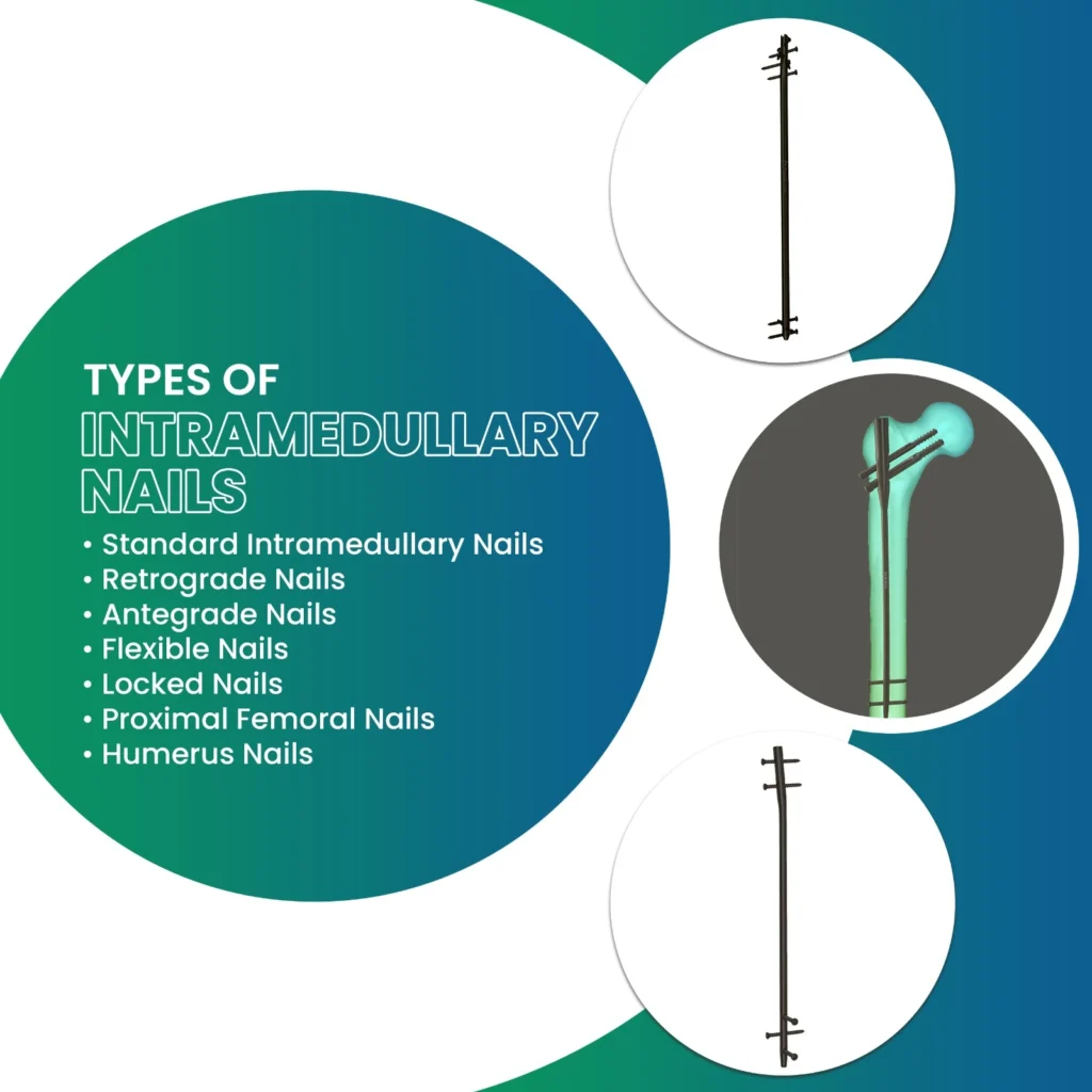 Range of Intramedullary Nail