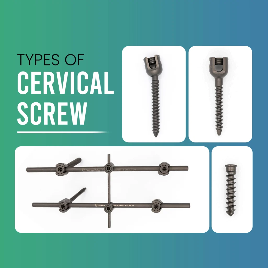 Types of Cervical Screw