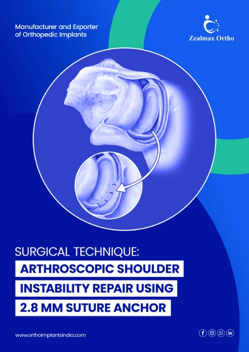 Arthroscopic Shoulder Instability Repair Using 2.8 mm Suture Anchor