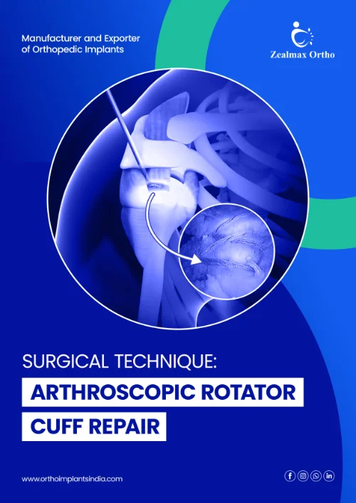 Arthroscopic Rotator Cuff Repair