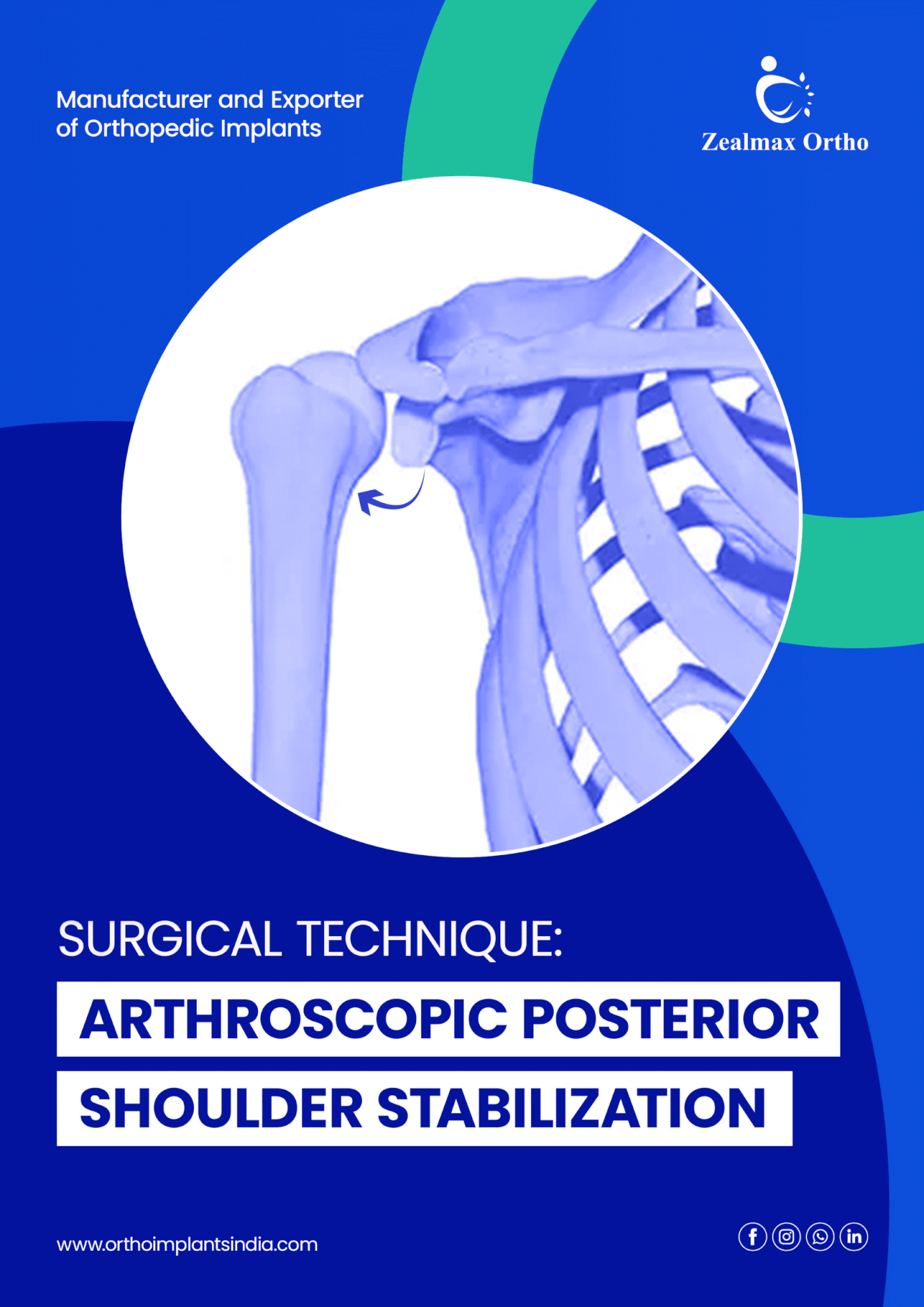 Arthroscopic Posterior Shoulder Stabilization
