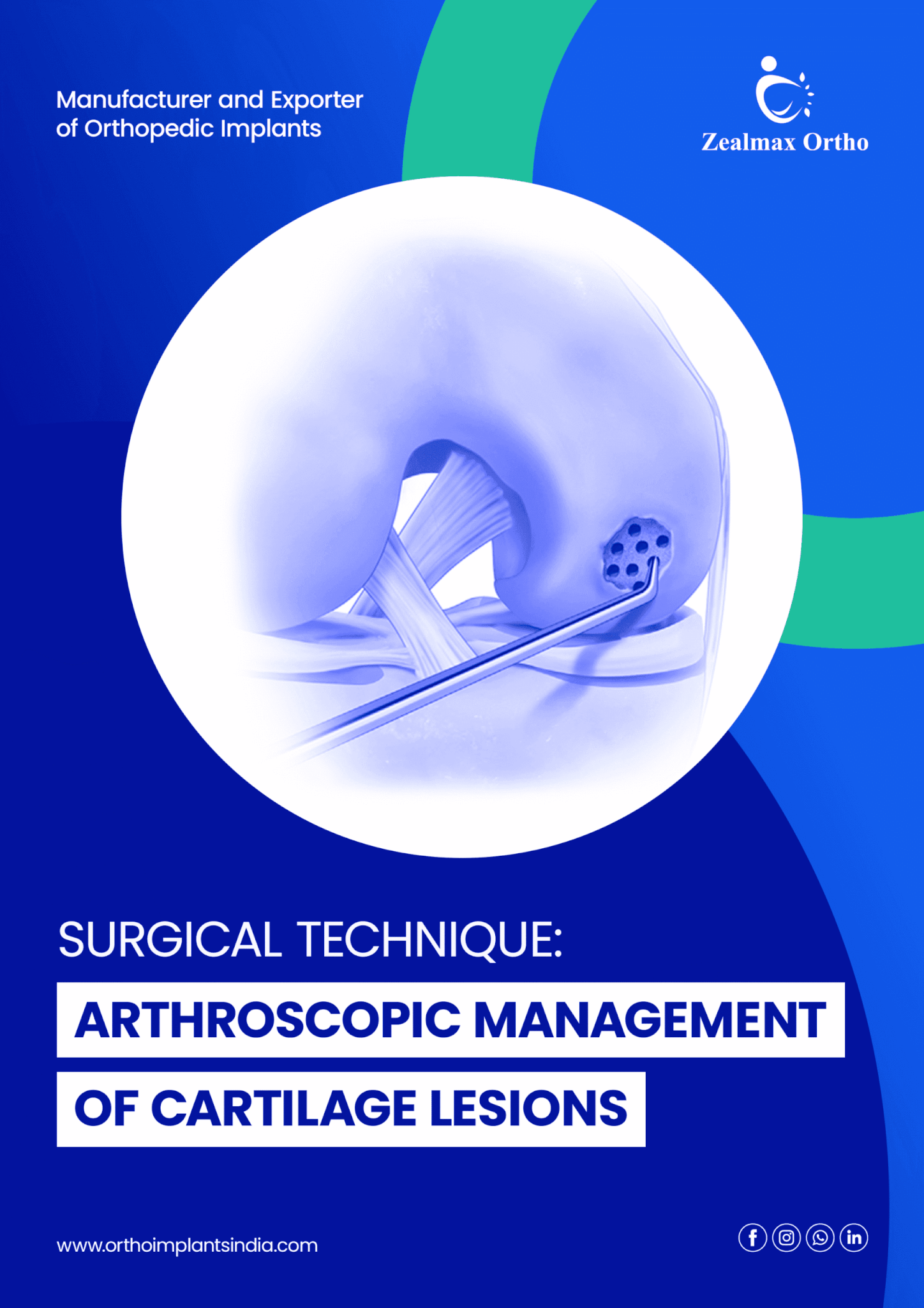 Arthroscopic Management of Cartilage Lesions
